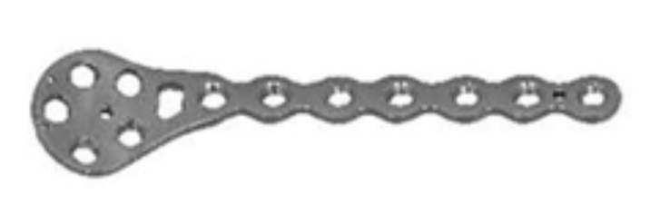 Блокуюча пластина для велигомілкової кістки для заднього краю UMP